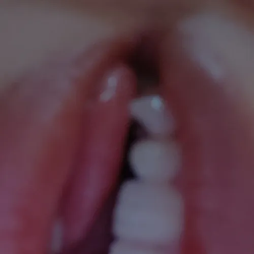 Aleera